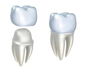 dental crown samples